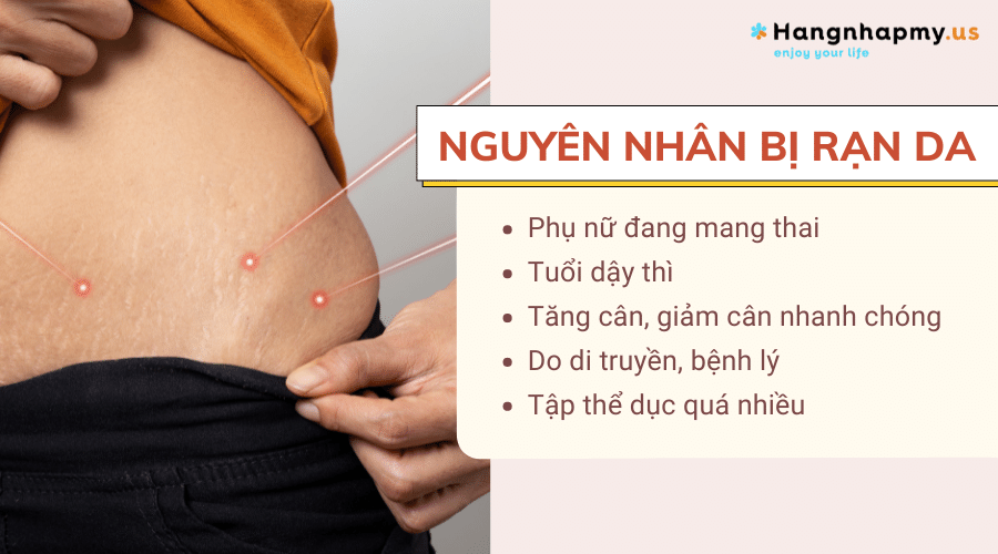 4. Phòng Ngừa Rạn Da Hiệu Quả